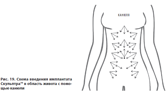 Рис 19