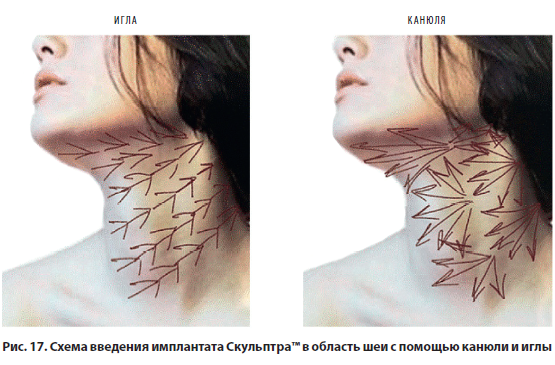 Рис. 17