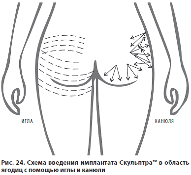 Рис. 24