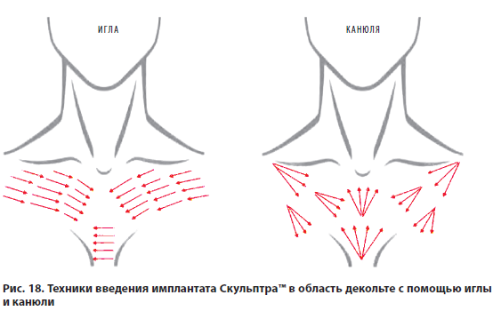 Рис 18