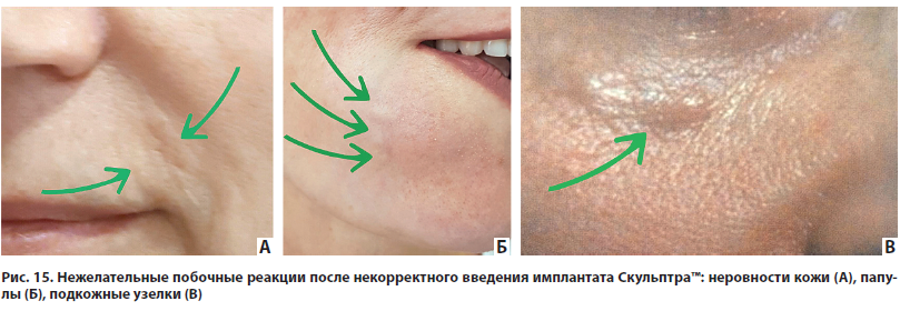 Рис. 15