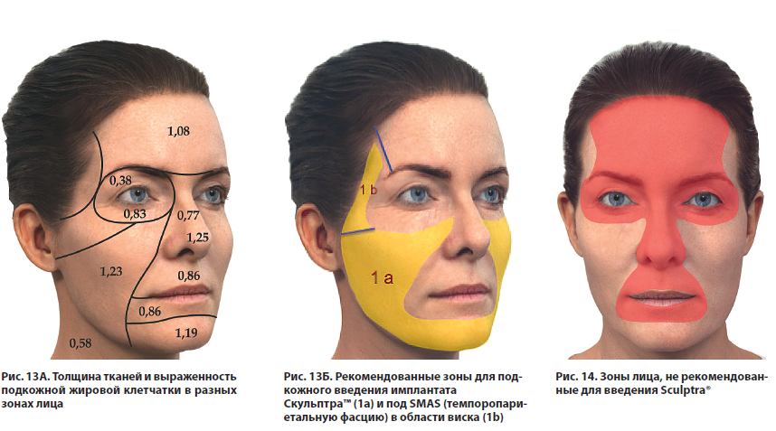Рис. 13