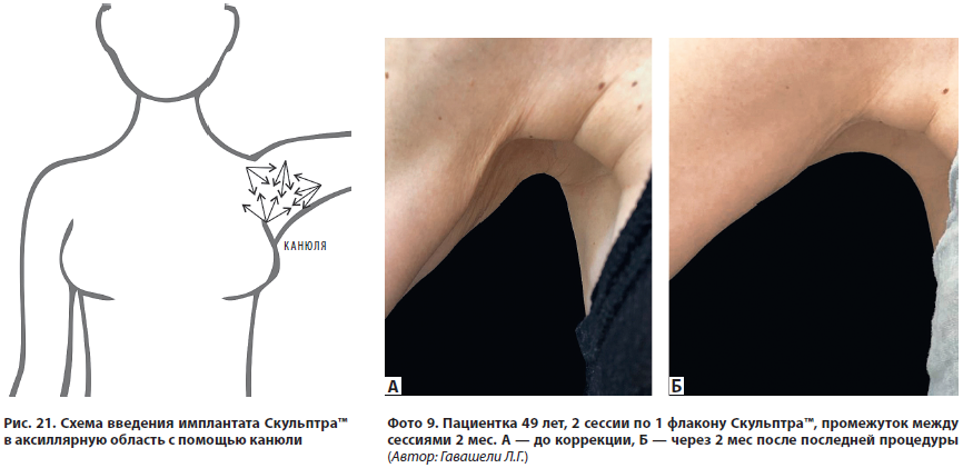 Рис 21
