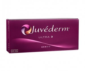 Juvederm ULTRA